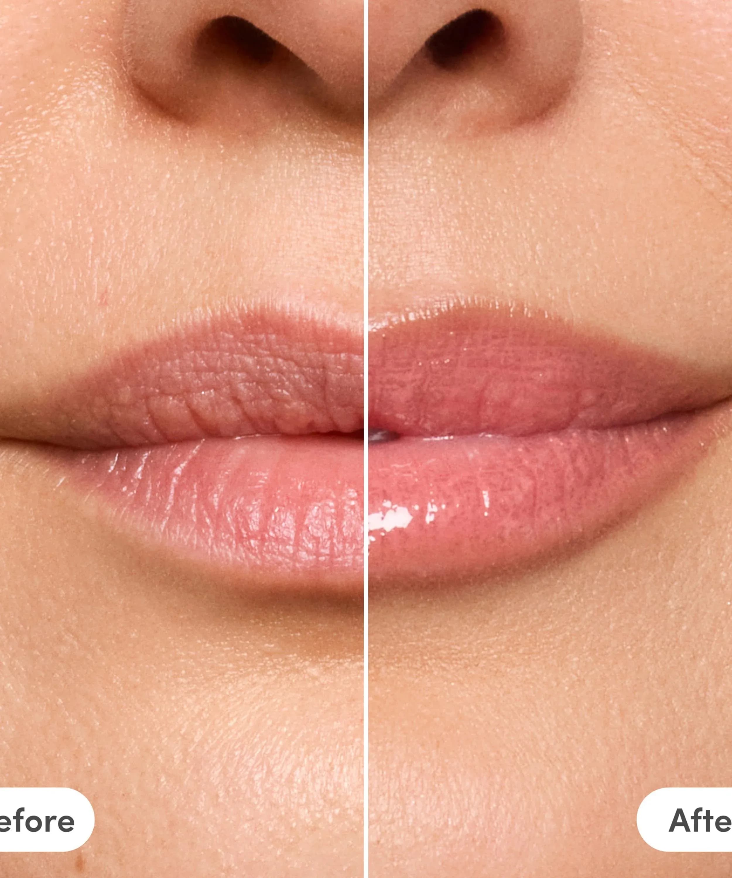 The Lip Reset Kit
