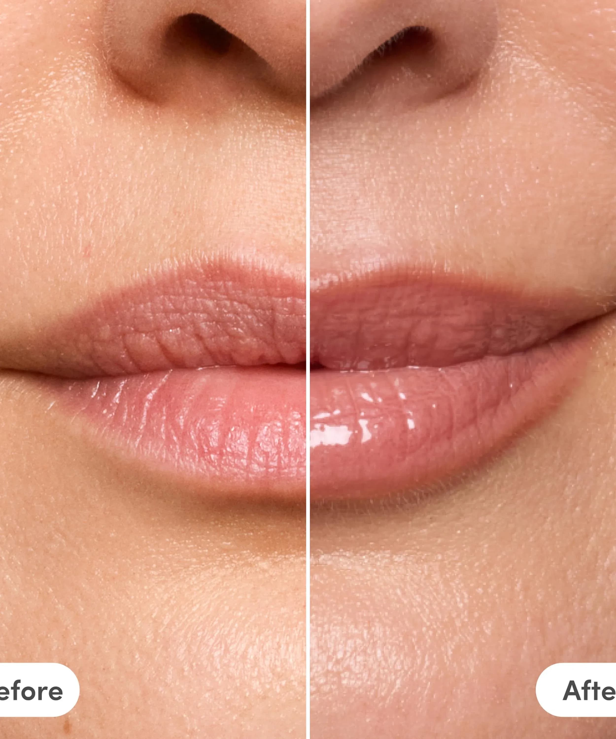 The Lip Reset Kit Liberty + Fran