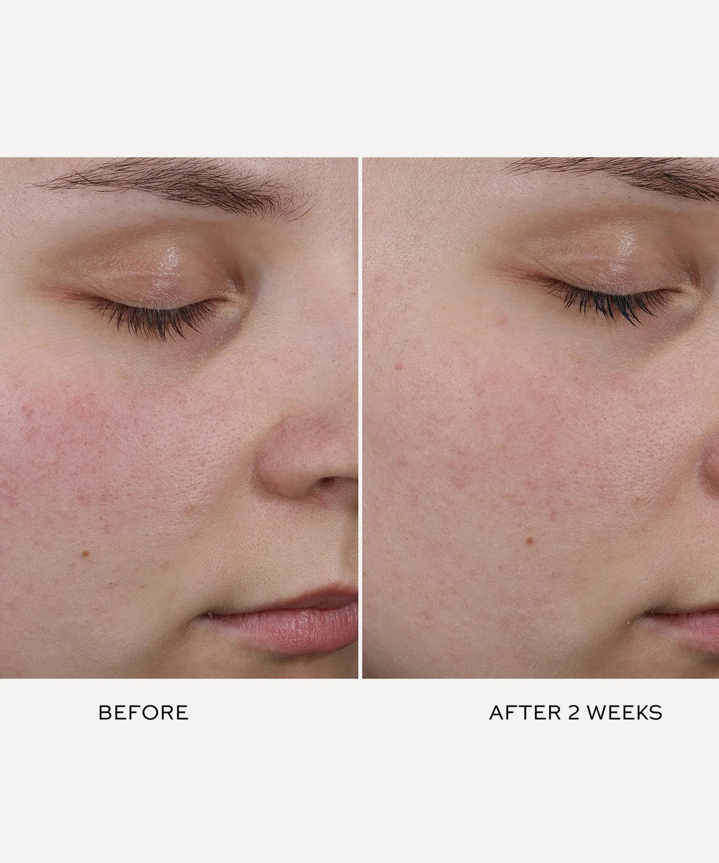 Pore Refining Complex 15ml
